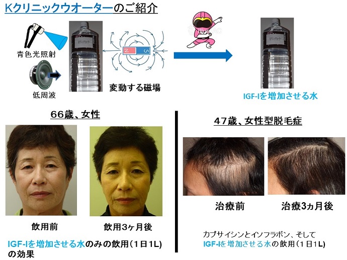 円形脱毛症　病院